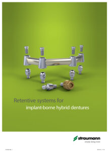 retentive-system-for-implant-borne-hybrid